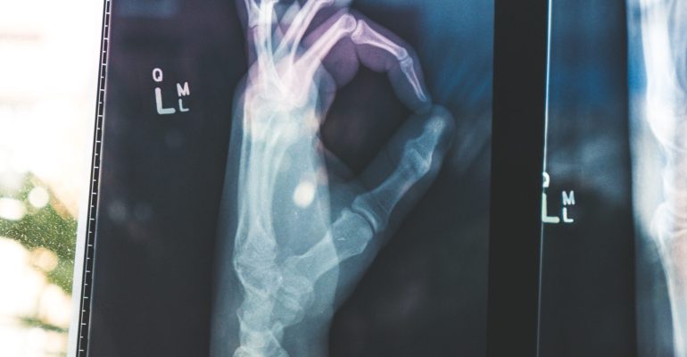 MI in Primary Care - Part 2